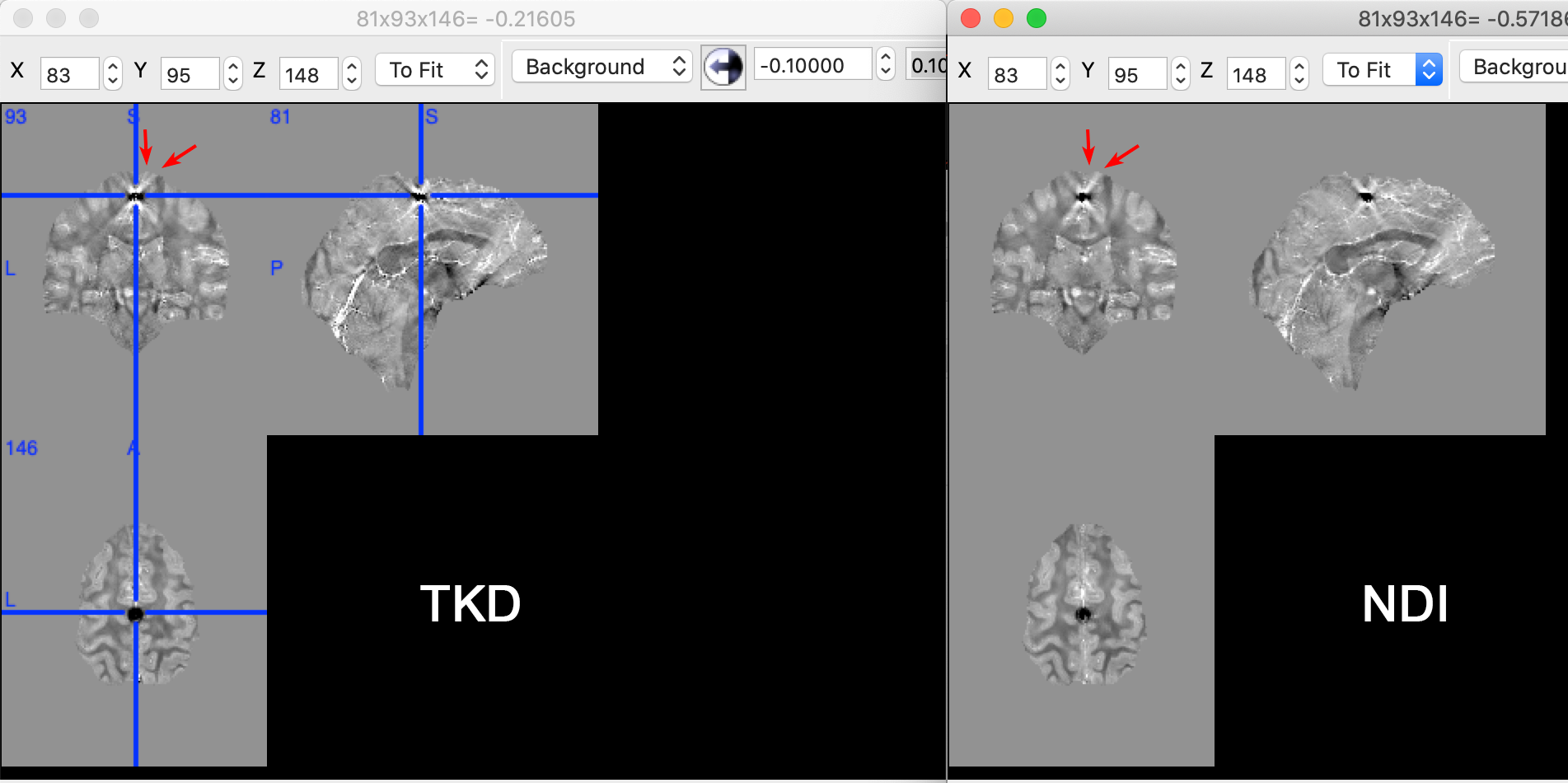 ../../_images/exercise4_ndi.png