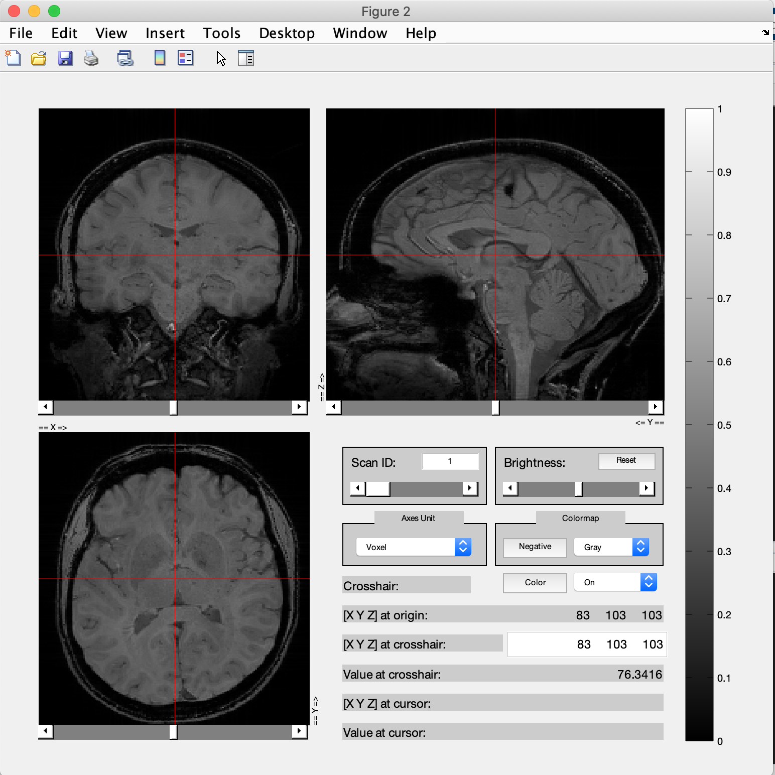 ../../_images/exercise1_viewnii.png