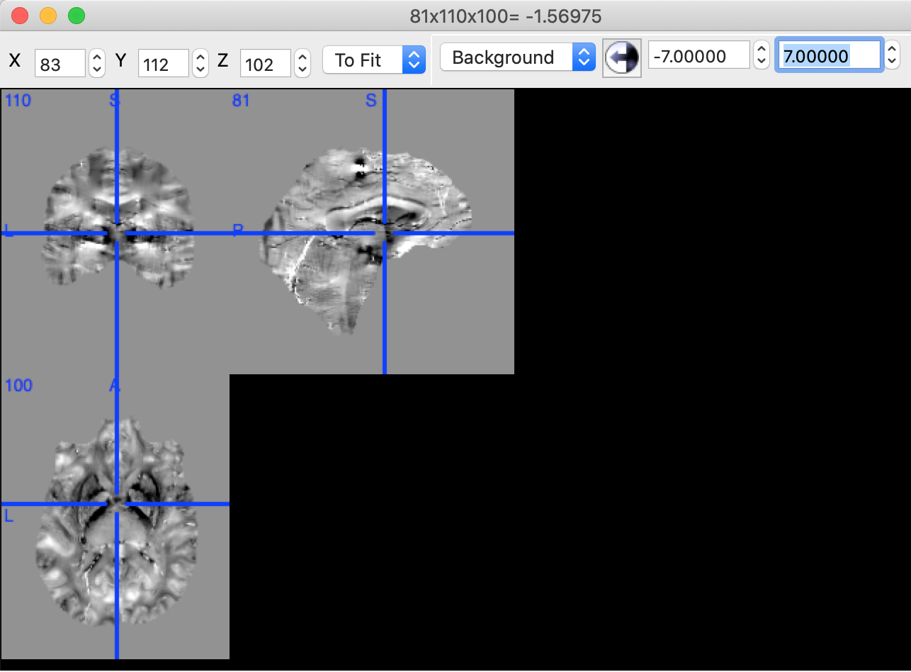 ../../_images/exercise3_localfield.png