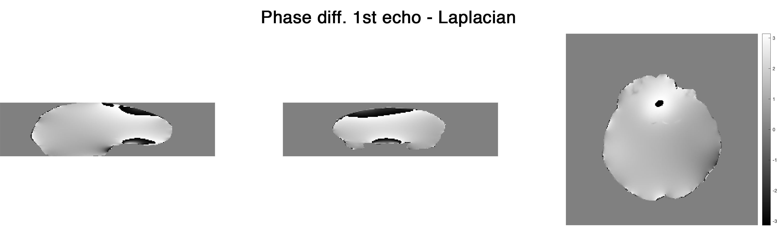 ../_images/phase-diff_laplacian_e-1.png