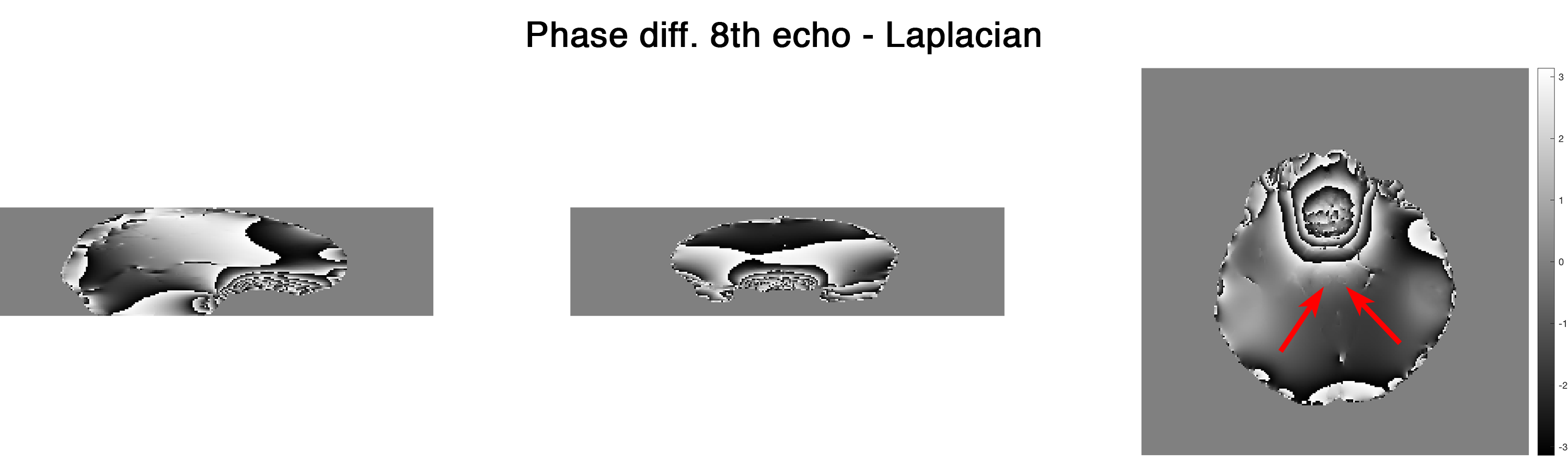../_images/phase-diff_laplacian_e-8.png