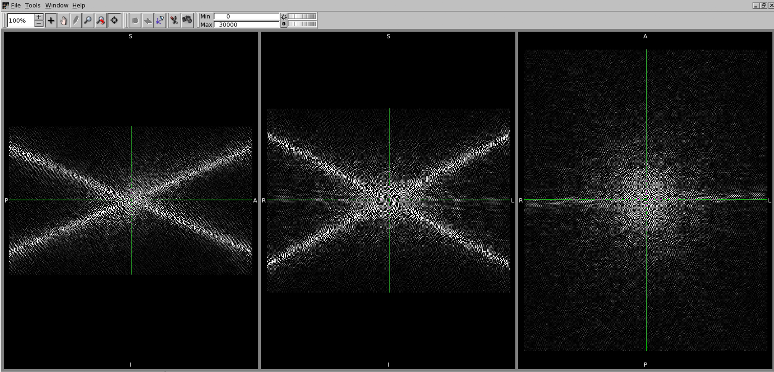 ../../_images/qsm_fourier_tkd-0.png