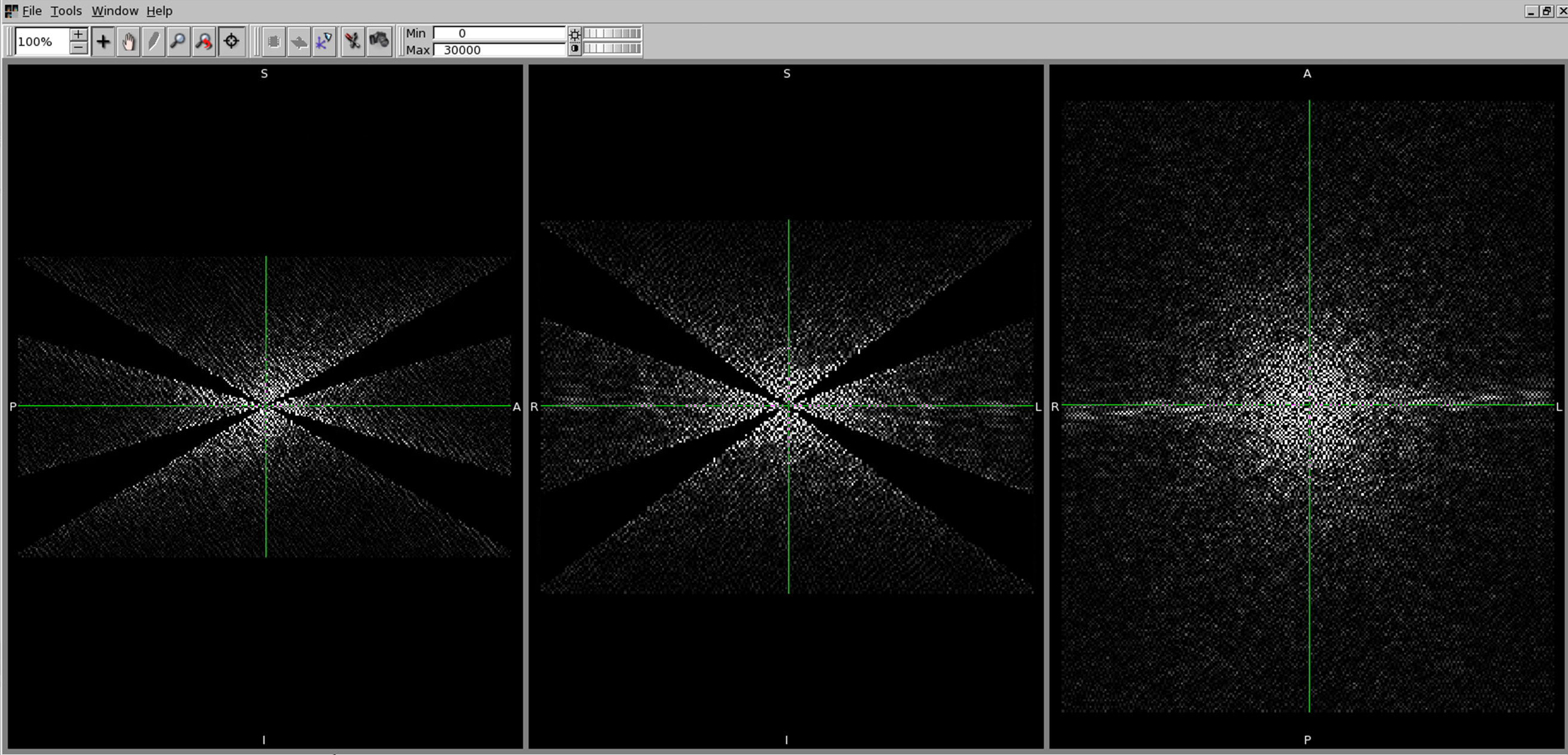 ../../_images/qsm_fourier_tkd-0p151.png
