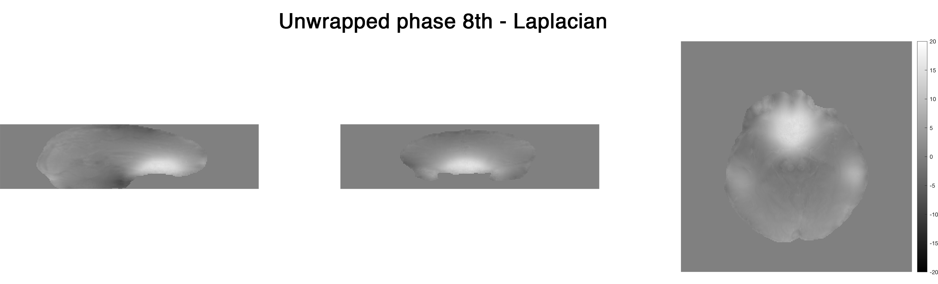 ../_images/unwrap-phase_laplacian_e-8.png