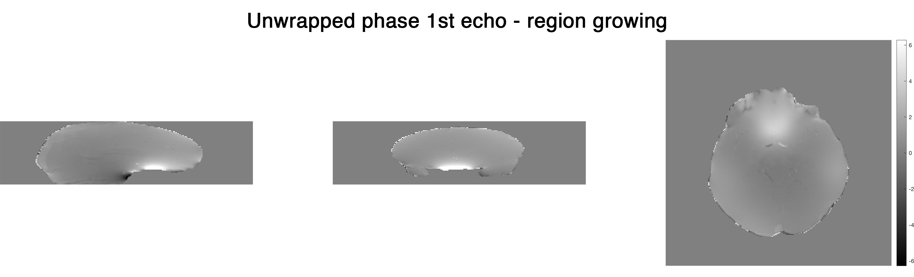 ../_images/unwrap-phase_rg_e-1.png