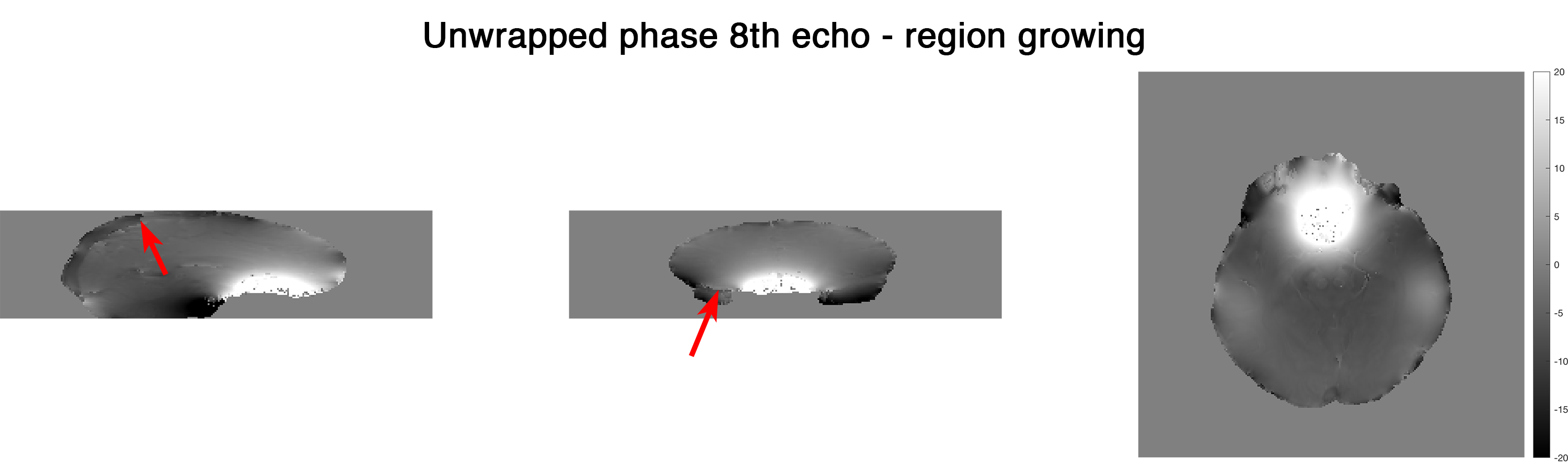 ../_images/unwrap-phase_rg_e-8.png
