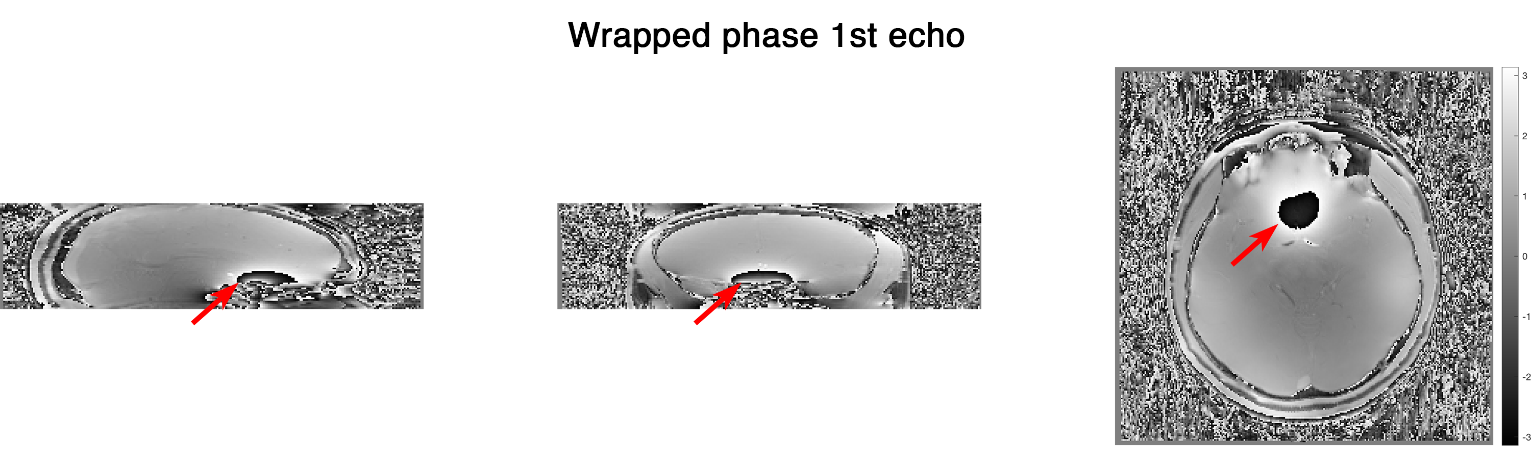 ../_images/wrap-phase_e-1.png