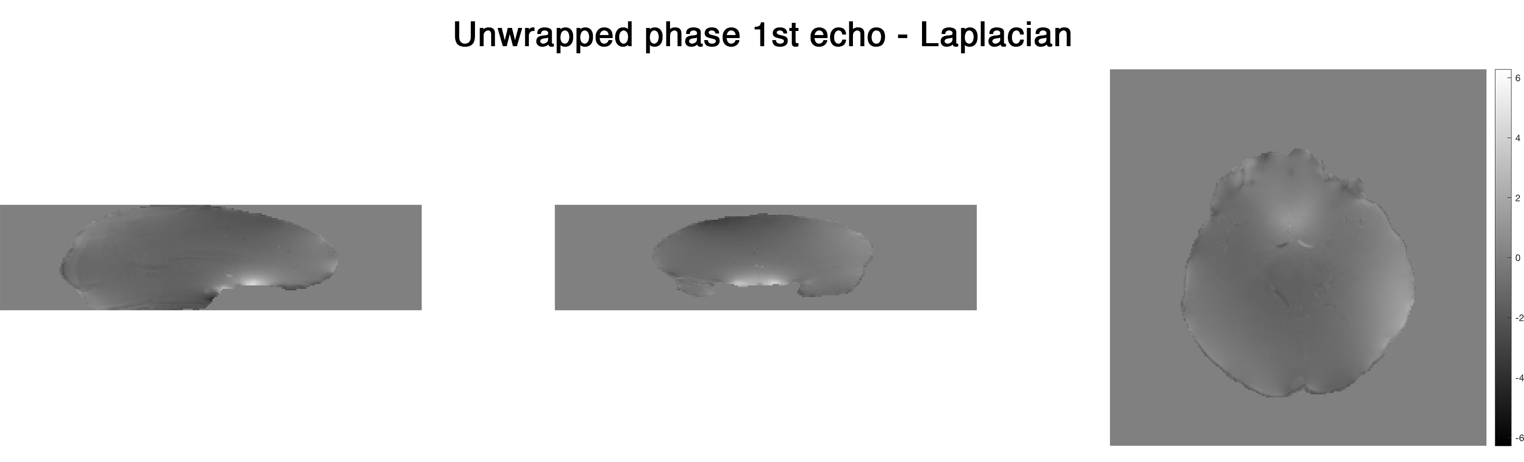 ../_images/unwrap-phase_laplacian_e-1.png